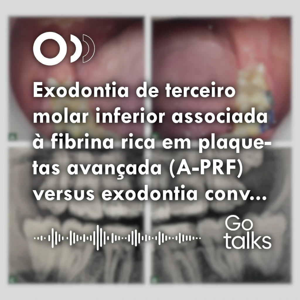 Exodontia de terceiro molar inferior associada à fibrina rica em plaquetas avançada (A-PRF) versus exodontia convencional: relato de caso clínico