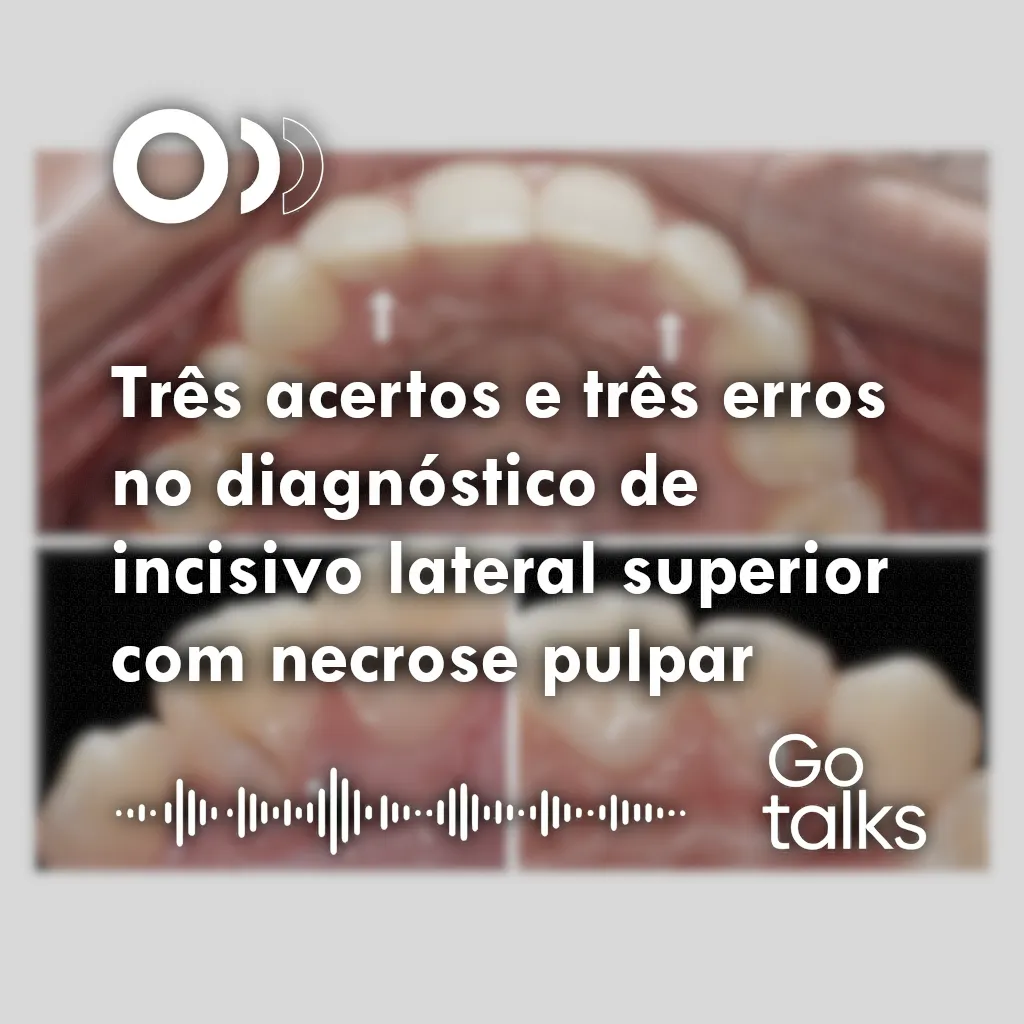 Três acertos e três erros no diagnóstico de incisivo lateral superior com necrose pulpar