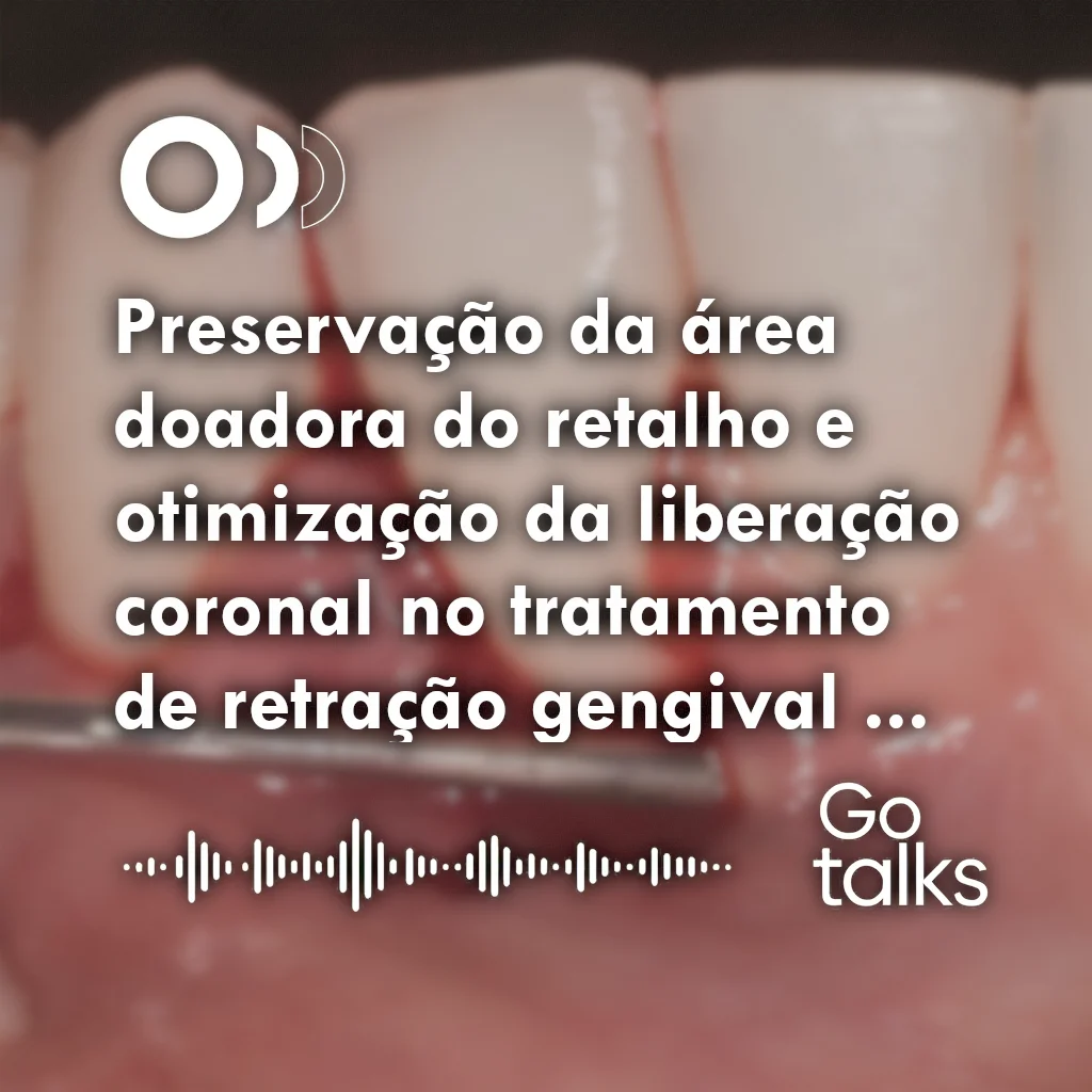 Preservação da área doadora do retalho e otimização da liberação coronal no tratamento de retração gengival unitária profunda em incisivo inferior