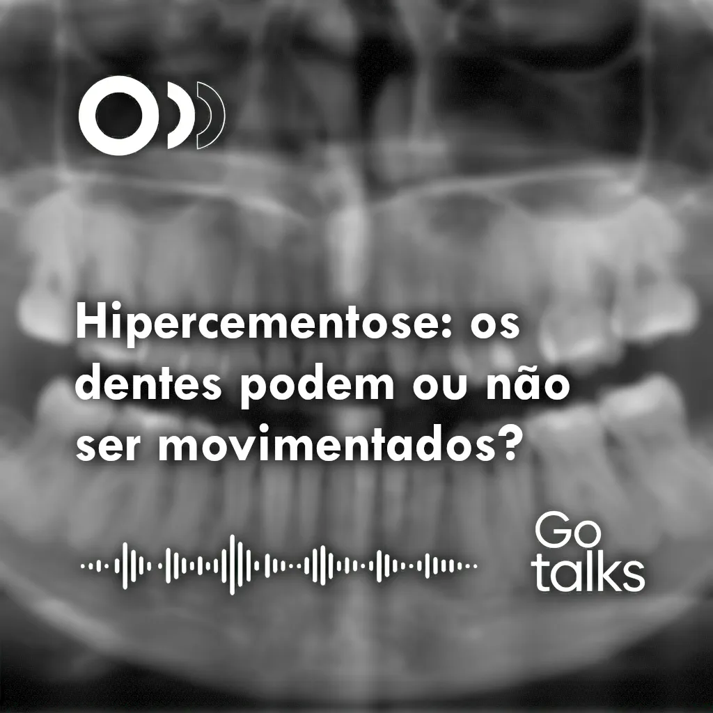 Hipercementose: os dentes podem ou não ser movimentados?