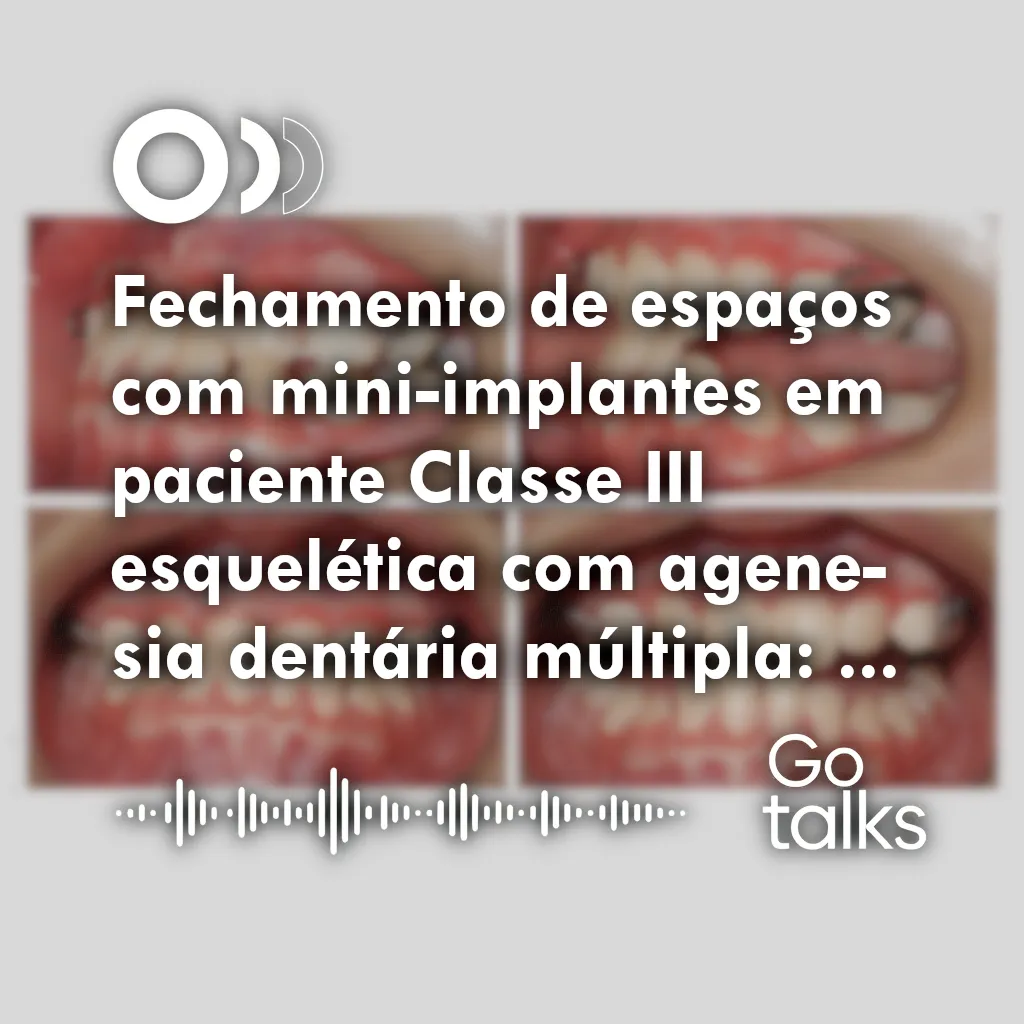Fechamento de espaços com mini-implantes em paciente Classe III esquelética com agenesia dentária múltipla: relato de caso