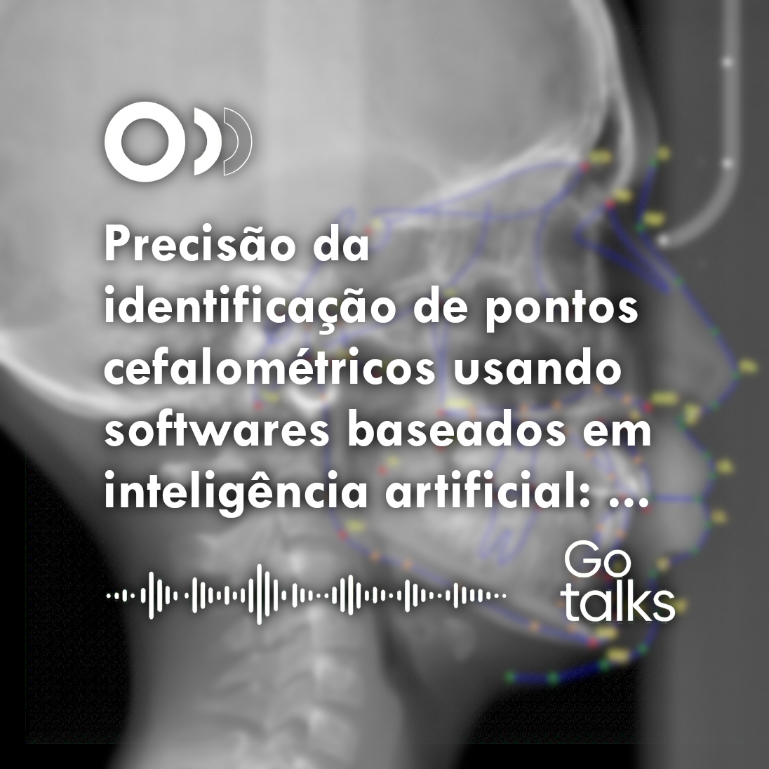 Precisão da identificação de pontos cefalométricos usando softwares baseados em inteligência artificial: um estudo comparativo