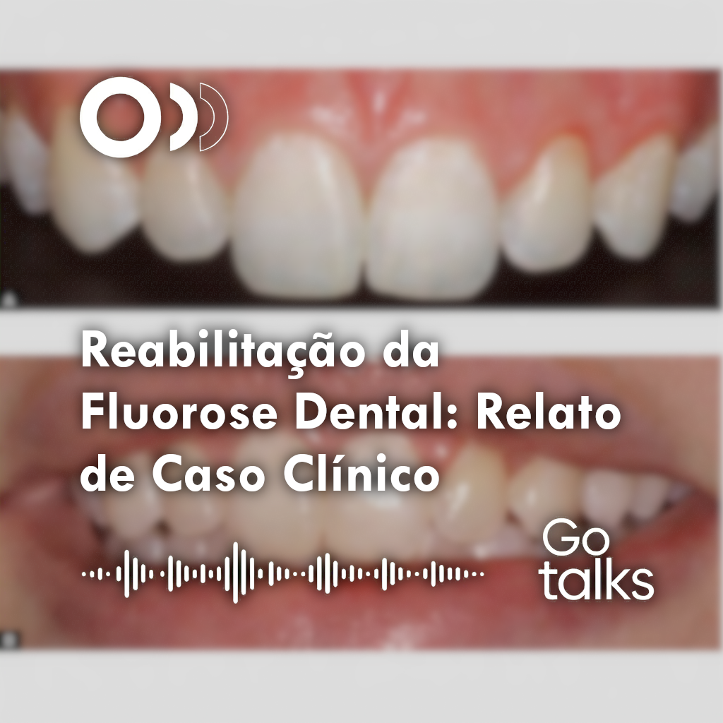 Reabilitação da Fluorose Dental: Relato de Caso Clínico