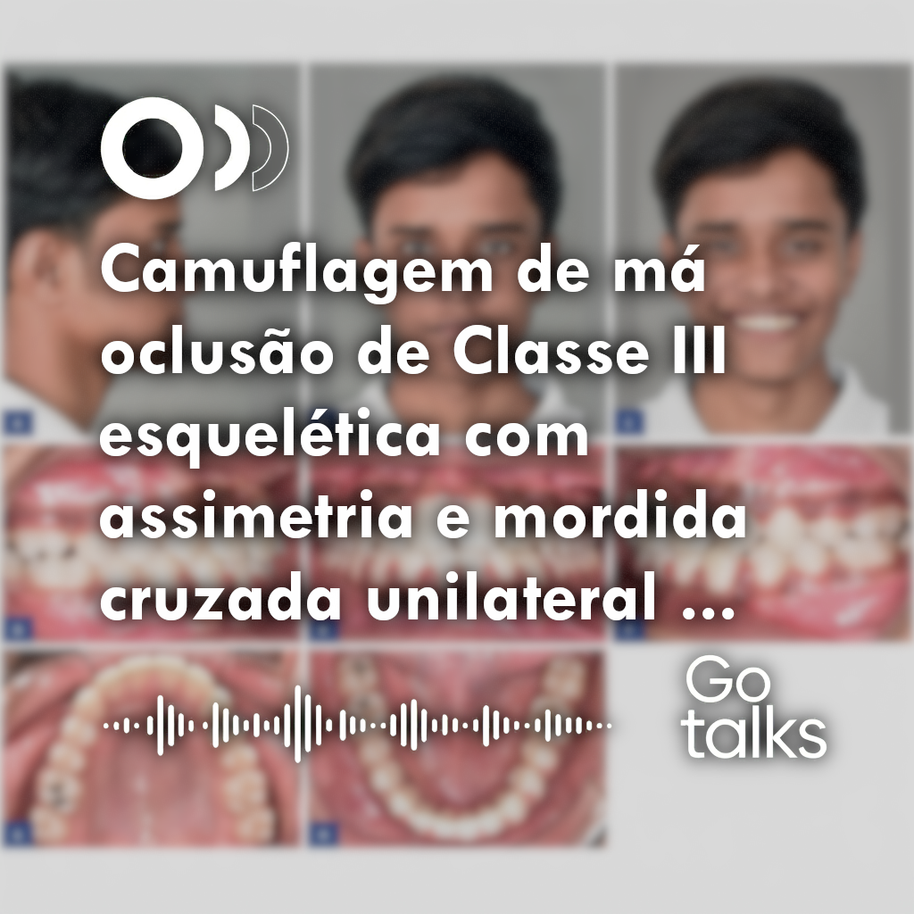 Camuflagem de má oclusão de Classe III esquelética com assimetria e mordida cruzada unilateral utilizando desprogramação oclusal: relato de caso